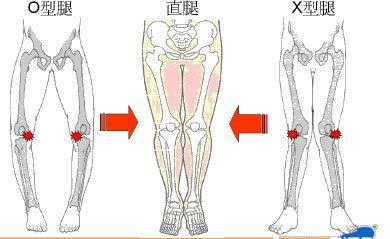 寶寶學步應循序漸進，過早站立或至O型腿內八字！