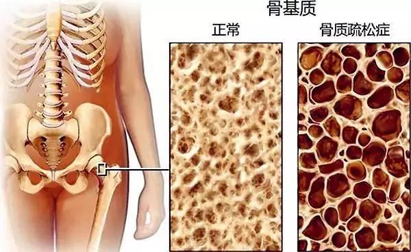 你的身體，從20 歲就開始老化了……